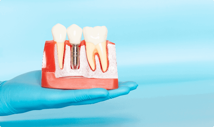 Gentle Dental Care hands on xray