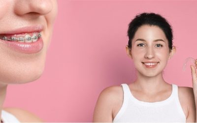 Clear Braces vs. Metal Braces: 2026 Sydney Orthodontic Guide
