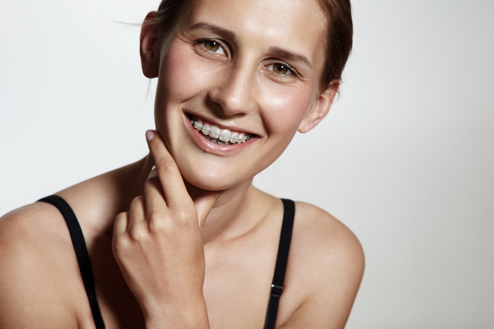 Ceramic Braces vs Metal Braces: Which Is Right for You in Sydney?