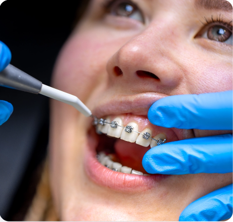 All On X Dental Implants Cost Sydney