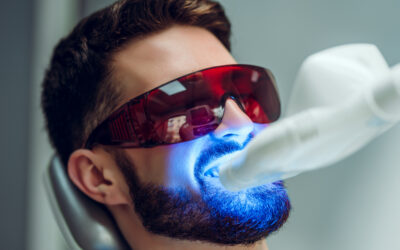 Professional vs. At-Home Teeth Whitening: Why In-Chair Treatment Wins