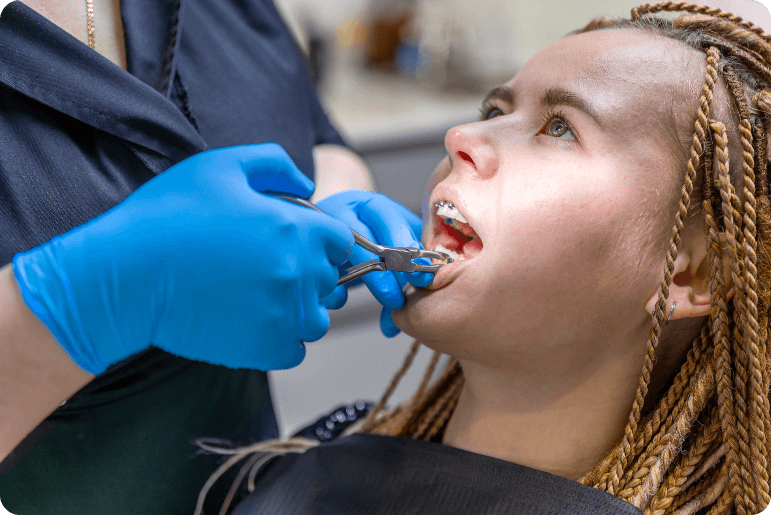 Dental Procedure Installing Braces Close Up Dentistry Braces Teeth (1) (1)