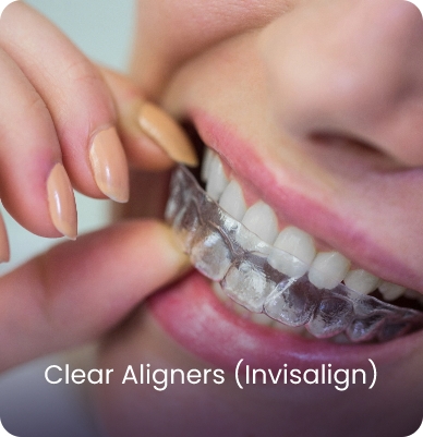 Invisalign