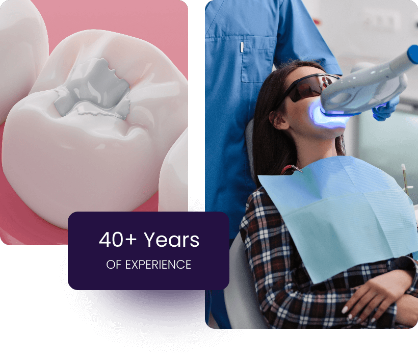 Tooth Fillings 23 Tooth Fillings 23