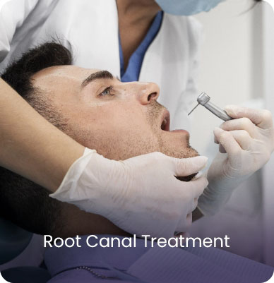 Root Canal Treatment