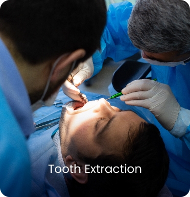 Tooth Extraction