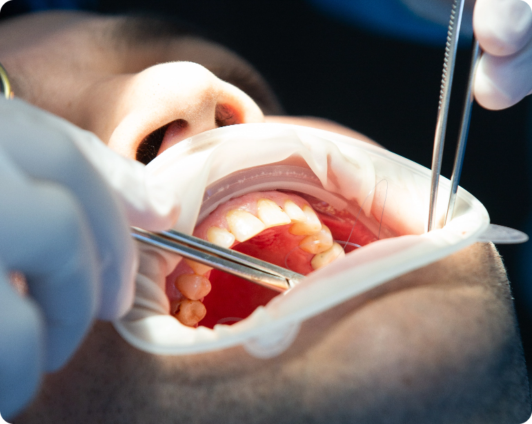 Pacient Dental Clinic While Operation