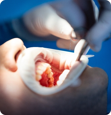 Emergency Dental Care