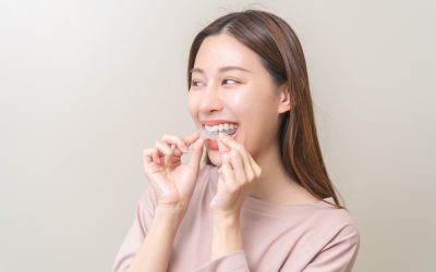 Transparent Braces – Everything You Need to Know